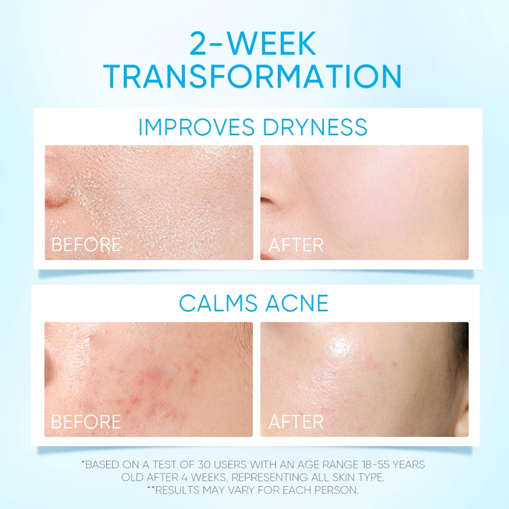 SKINTIFIC 5X Ceramide Moisturizer